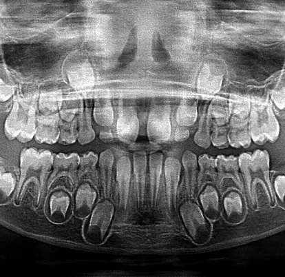 Orthodontics (Imaging and Planning)