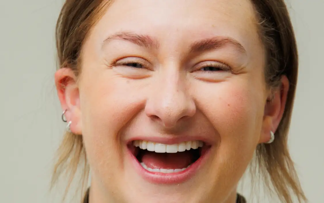 composite bonding testimonial london - kate monaghan
