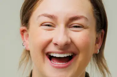 When Should You Get Composite Bonding? Image