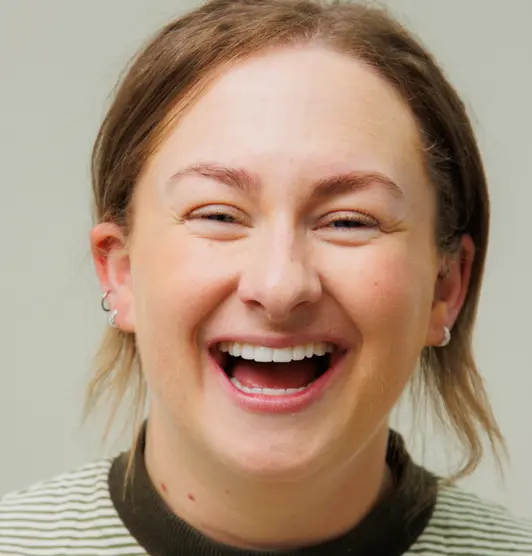 After Composite bonding - The Modern Dentist - Kate Monaghan