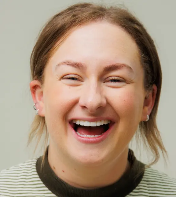 After Composite bonding - The Modern Dentist - Kate Monaghan