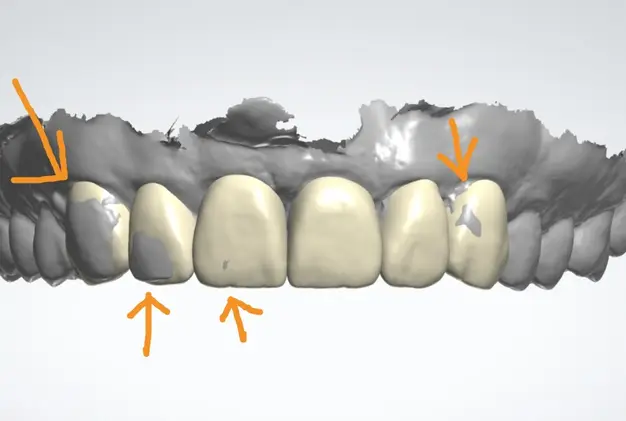 Laughing Woman Image