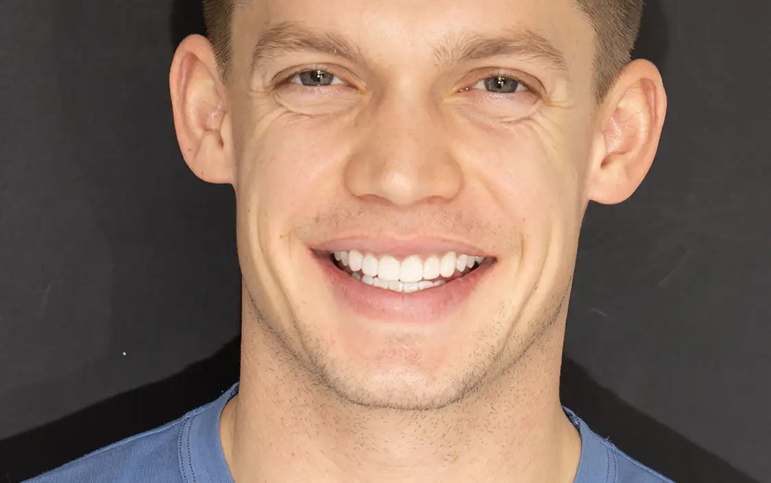 Chris after treatment