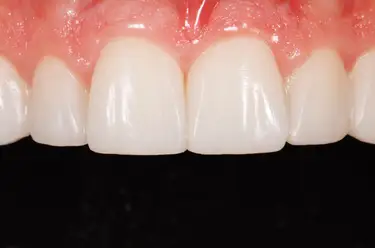 What is Orthodontics? Image