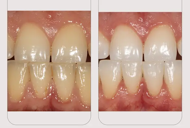 Laughing Woman Image