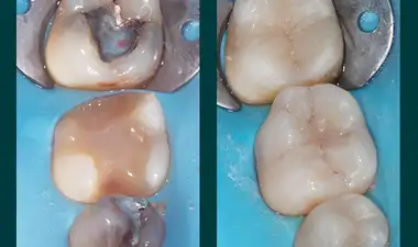 General Dentistry Image