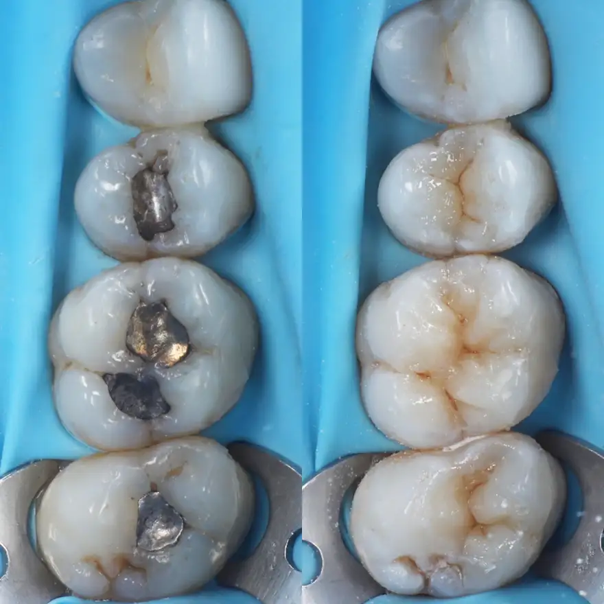 dr. mark flynn - the modern dentist