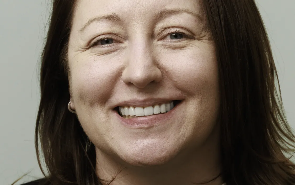 Invisalign Rachel - The Modern Dentist