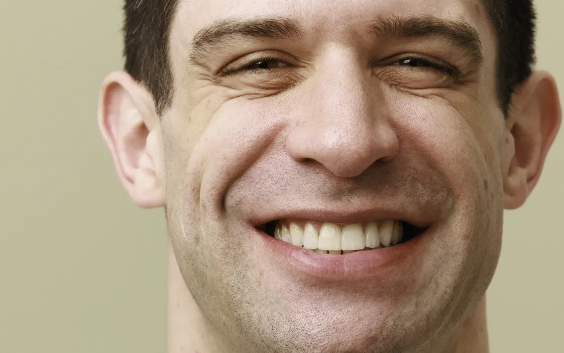 Piers Orthdontics after - The Modern Dentist