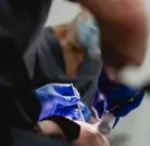 Implant Procedure