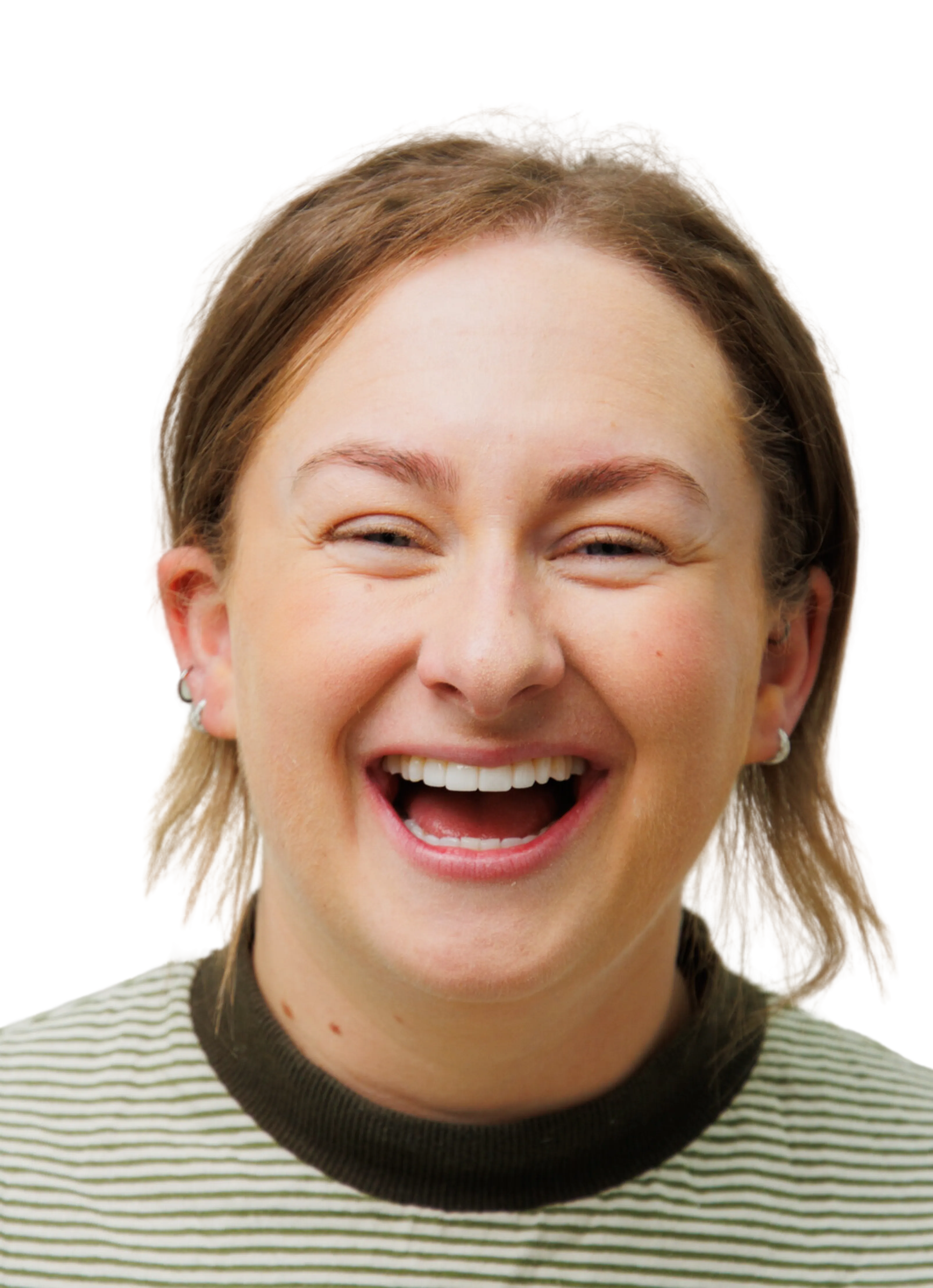 what is composite bonding - the modern dentist