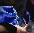 Treatment