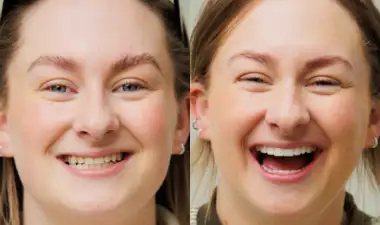 Cosmetic Dentistry Image