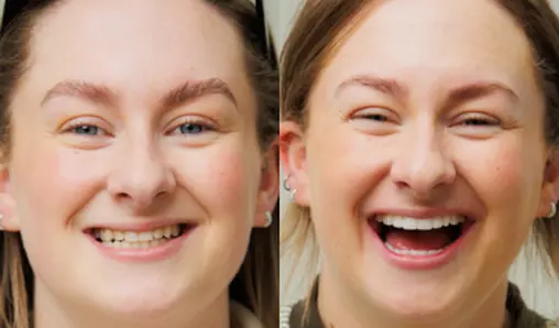 Smile Gallery - the modern dentist