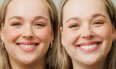 The Modern Smile Image