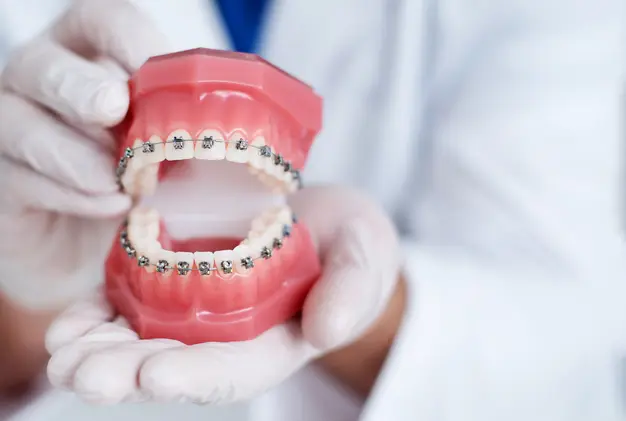 Which Braces Are Available For Children?
