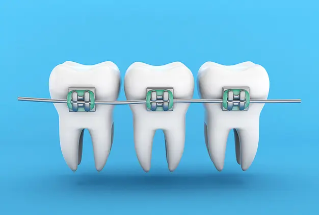 What Is The Cost Of Kids' Braces?