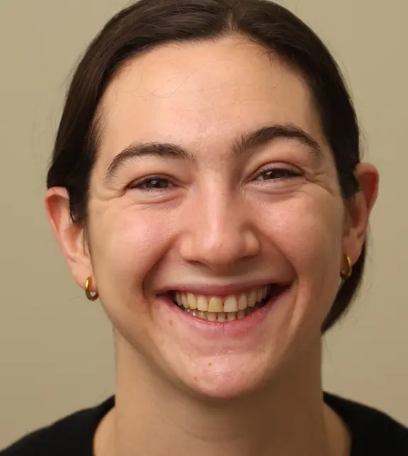 Julia Before Treatment