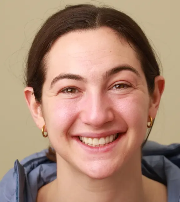 Julia After Treatment