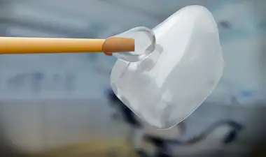 Porcelain veneers Image