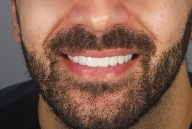 Who Is A Good Candidate For Ceramic Braces?