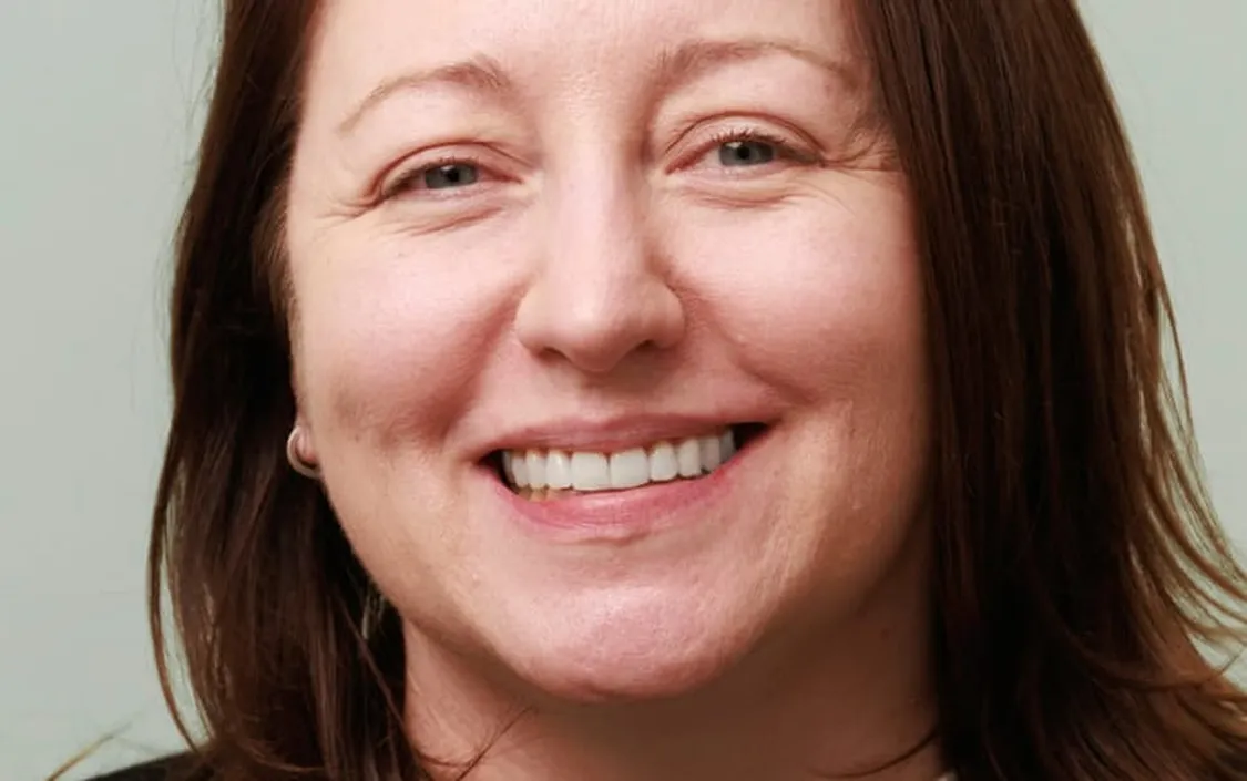 Invisalign Rachel - The Modern Dentist