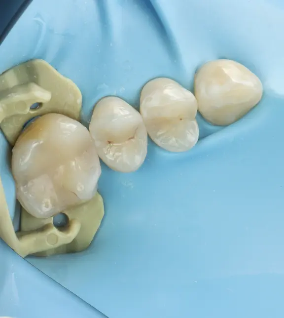 Final appearance of tooth