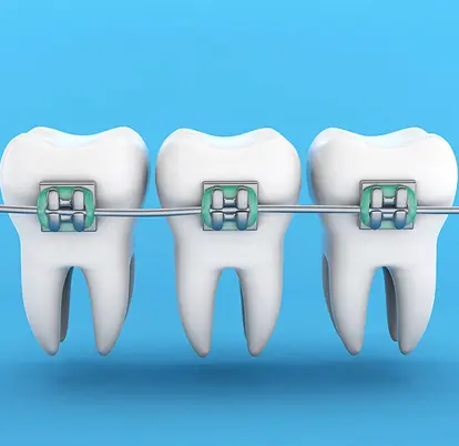 Orthodontics Treatment (Fitting Your Braces)