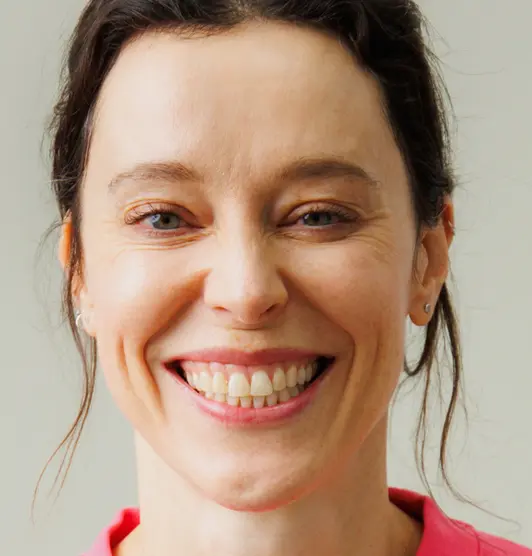 Smile Before - Full Face - Bonding - Laura