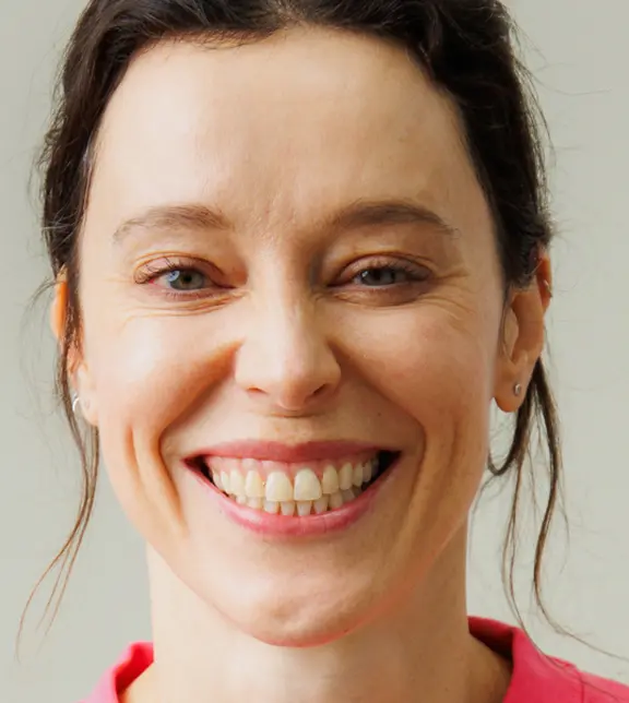 Smile Before - Full Face - Bonding - Laura