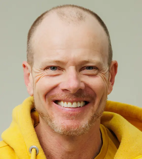 Smile Before Treatment