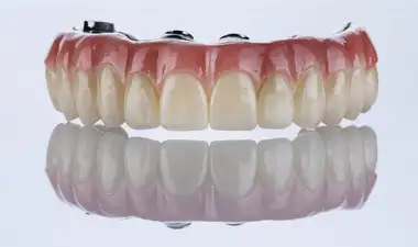 Smile in a Day Image
