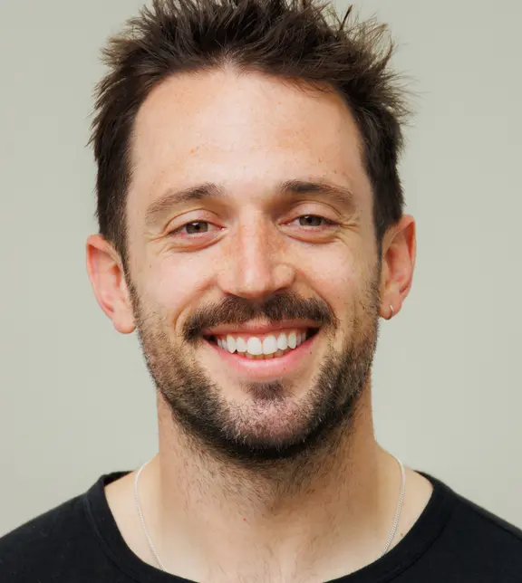 Invisalign - after - Tom - The Modern Dentist