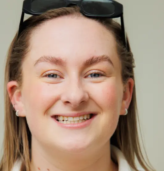 composite bonding before kate monaghan the modern dentist