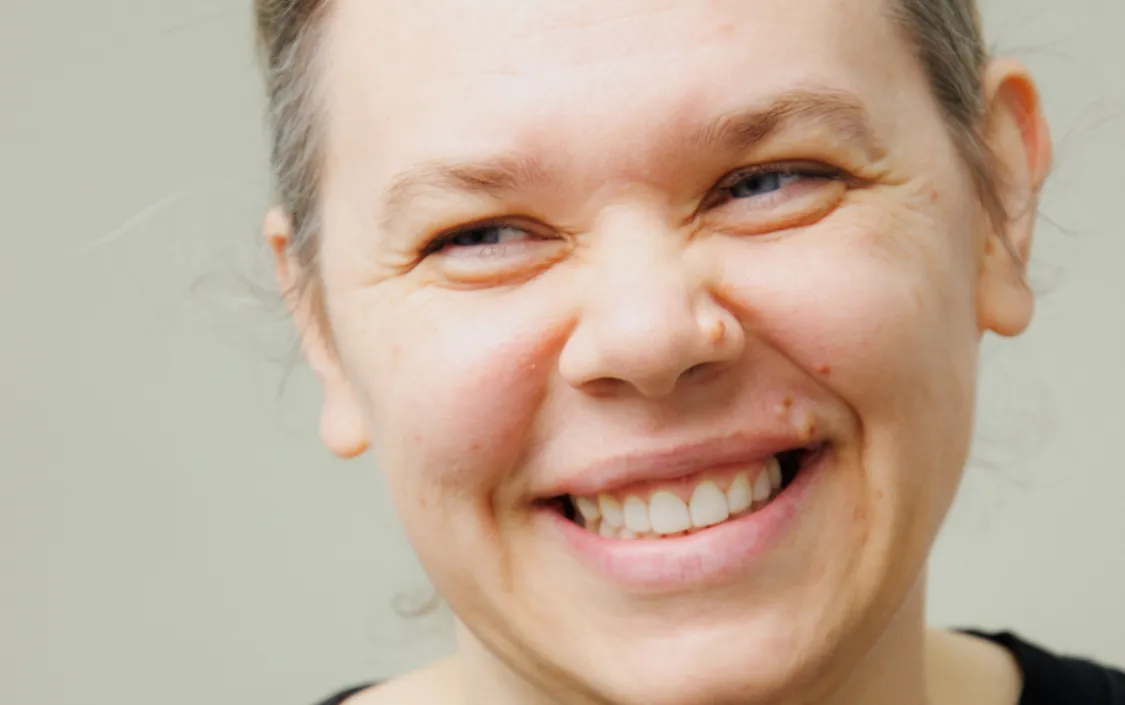 Composite Bonding Testimonial - Anna - The Modern Dentist
