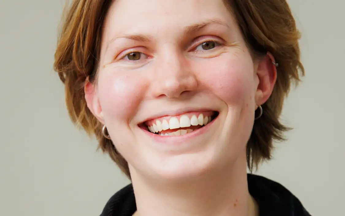 bonding after - smile - Ruth - The Modern Dentist