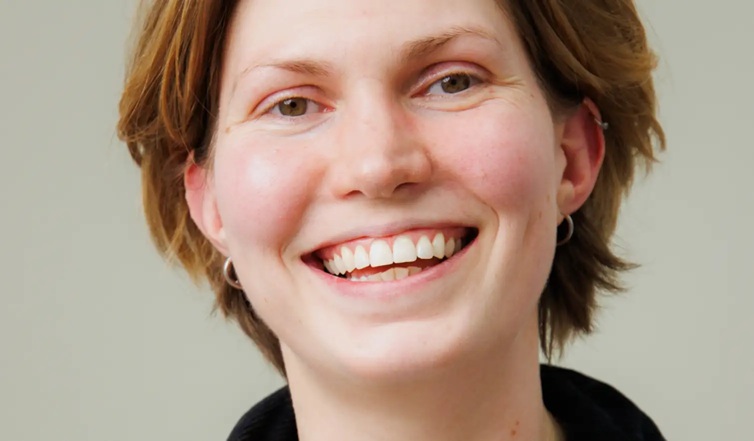 bonding after - smile - Ruth - The Modern Dentist
