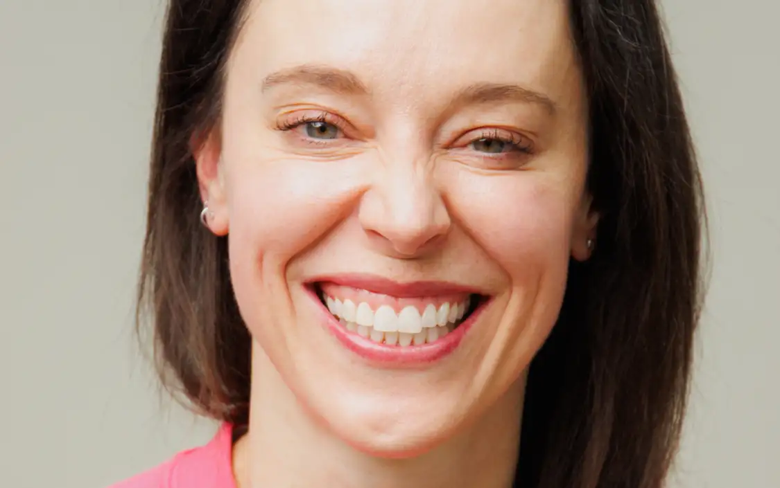 bonding after - smile - Laura - The Modern Dentist