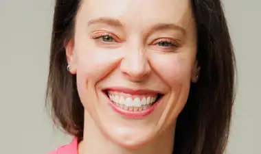 bonding after - smile - Laura - The Modern Dentist