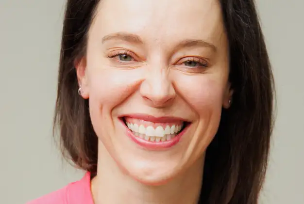 bonding after - smile - Laura - The Modern Dentist