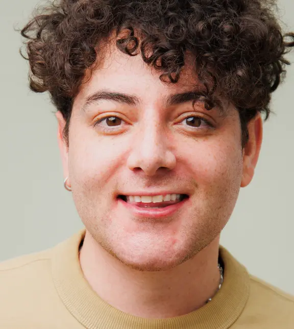 Corbyn (ortho & bonding) - full face - after