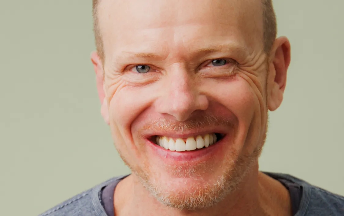 Composite Bonding Testimonial - Douglas - The Modern Dentist