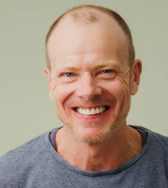 Smile After Treatment