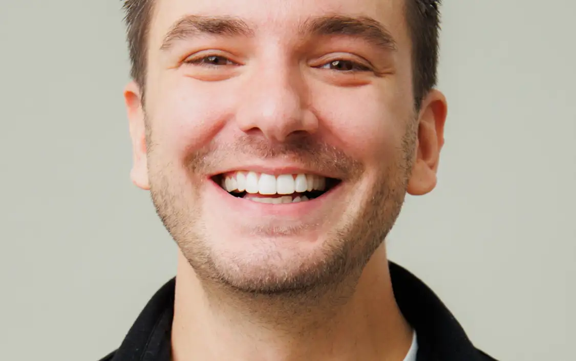 Bonding testimonial - Mark Farrant - The Modern Dentist